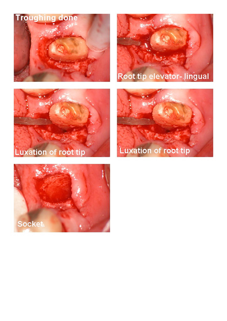 36 exo root tips pg 2.jpg